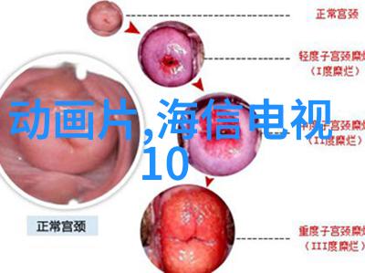 光催化杀菌消毒设备在医疗环境中的应用研究与展望